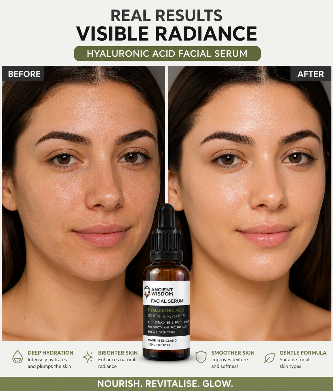 Before and after comparison of a woman's face with a bottle of hyaluronic acid facial serum.